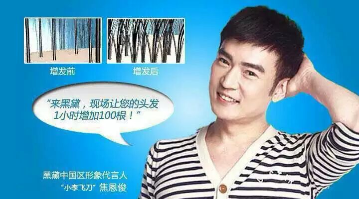 泉州假發增發注意哪些事項，來黒黛了解0595-22867702