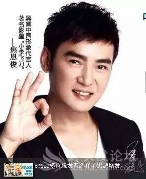 假發與增發有什么不同嗎？