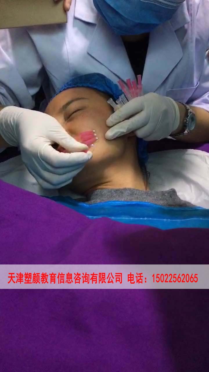 河北牙齒美白培訓(xùn)班-塑顏微整形