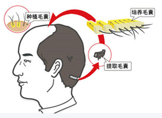 廣州植發zl中心-廣州瑞麗詩植發醫院